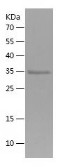    LGR6 / Recombinant Human LGR6