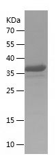    MAVS / Recombinant Human MAVS