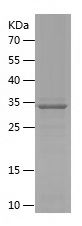    SGCE / Recombinant Human SGCE