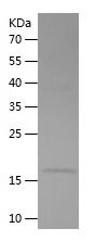 Recombinant Mouse CKB