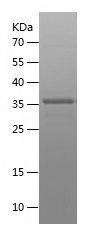    CLU / Recombinant Human CLU