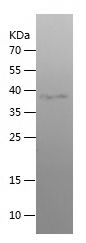    WFS1 / Recombinant Human WFS1