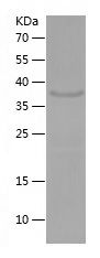    FGF22 / Recombinant Human FGF22