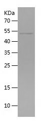    PDK4-2 / Recombinant Human PDK4-2