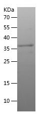    BEX2 / Recombinant Human BEX2