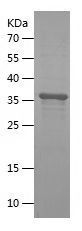    GPLD1 / Recombinant Human GPLD1