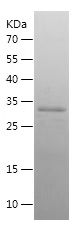    CLDN5 / Recombinant Human CLDN5