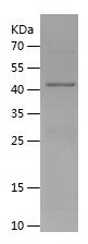    PLIN2 / Recombinant Human PLIN2