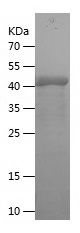    SSX1 / Recombinant Human SSX1