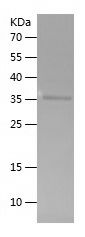    VANGL2 / Recombinant Human VANGL2