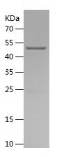    PLGF / Recombinant Human PLGF