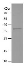    MBL2 / Recombinant Human MBL2