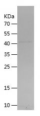    MAGEC3 / Recombinant Human MAGEC3