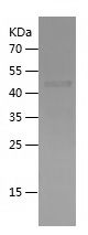    IL6R / Recombinant Human IL6R