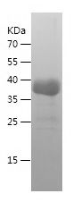    NTXI / Recombinant Human NTXI