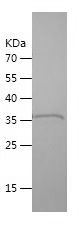    IL7 / Recombinant Human IL7