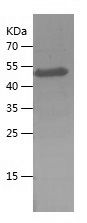    MAGEC2 / Recombinant Human MAGEC2