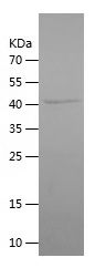    ORM2 / Recombinant Human ORM2