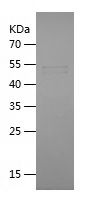 Recombinant Mouse Podxl