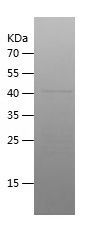    JUNB / Recombinant Human JUNB