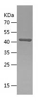    CLPP / Recombinant Human CLPP