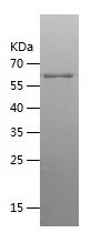    CKB / Recombinant Human CKB