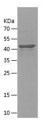    DGKA / Recombinant Human DGKA