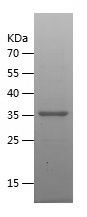    DHRS9 / Recombinant Human DHRS9