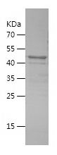    COLEC11 / Recombinant Human COLEC11