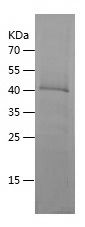    EIF2S3 / Recombinant Human EIF2S3