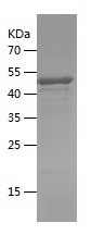    SETD1B / Recombinant Human SETD1B