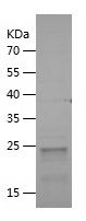    COIL / Recombinant Human COIL