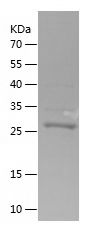    COX7C / Recombinant Human COX7C