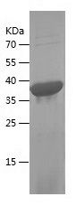    DIS3L2 / Recombinant Human DIS3L2