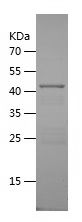    AHSG / Recombinant Human AHSG