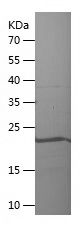    CCDC86 / Recombinant Human CCDC86