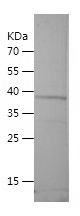    FCN3 / Recombinant Human FCN3