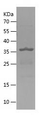    DPP3 / Recombinant Human DPP3