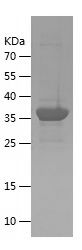    CHTF18 / Recombinant Human CHTF18