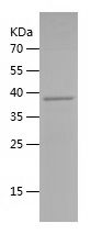    CYP2C8 / Recombinant Human CYP2C8