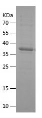    DCN / Recombinant Human DCN