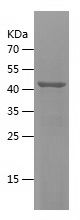    CHST15 / Recombinant Human CHST15