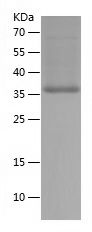    ZFYVE27 / Recombinant Human ZFYVE27