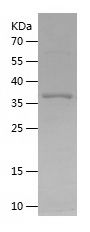    CYP7B1 / Recombinant Human CYP7B1