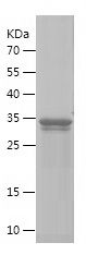    KISS1R / Recombinant Human KISS1R