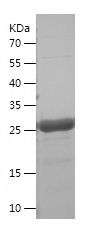    ATP6V1E1 / Recombinant Human ATP6V1E1