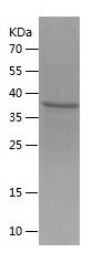    CD99 / Recombinant Human CD99