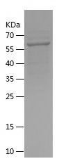    CD4 / Recombinant Human CD4