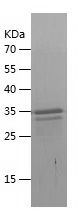    CXCL14 / Recombinant Human CXCL14