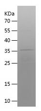    DDC / Recombinant Human DDC